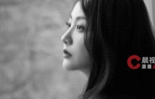 演员杨蓉晒烫伤后疤痕恢复照,称“带疤的脸很酷”