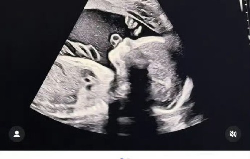 宋承炫为什么选择退出演艺圈并移居美国生活？